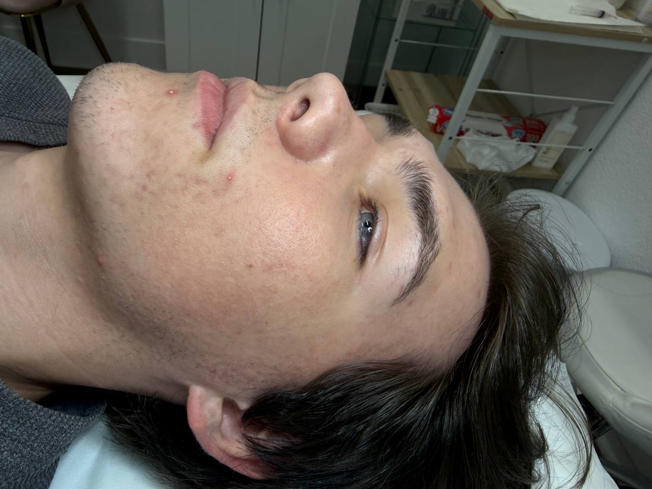 Skin at H.A. Skin Lab, treatment photo