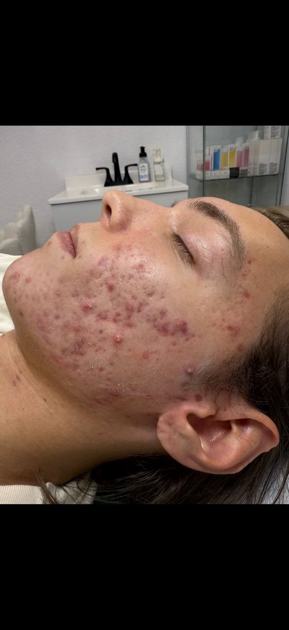 Skin at H.A. Skin Lab, treatment photo