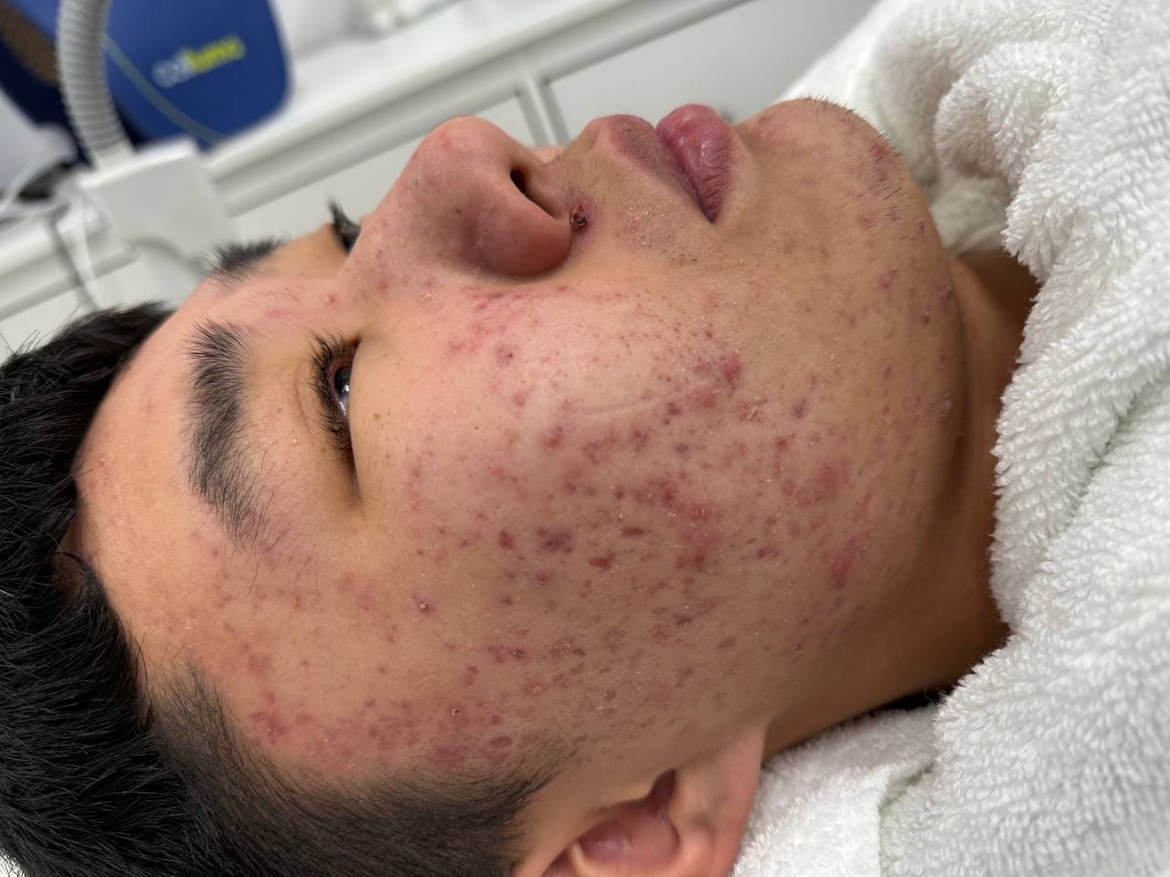Skin at H.A. Skin Lab, treatment photo