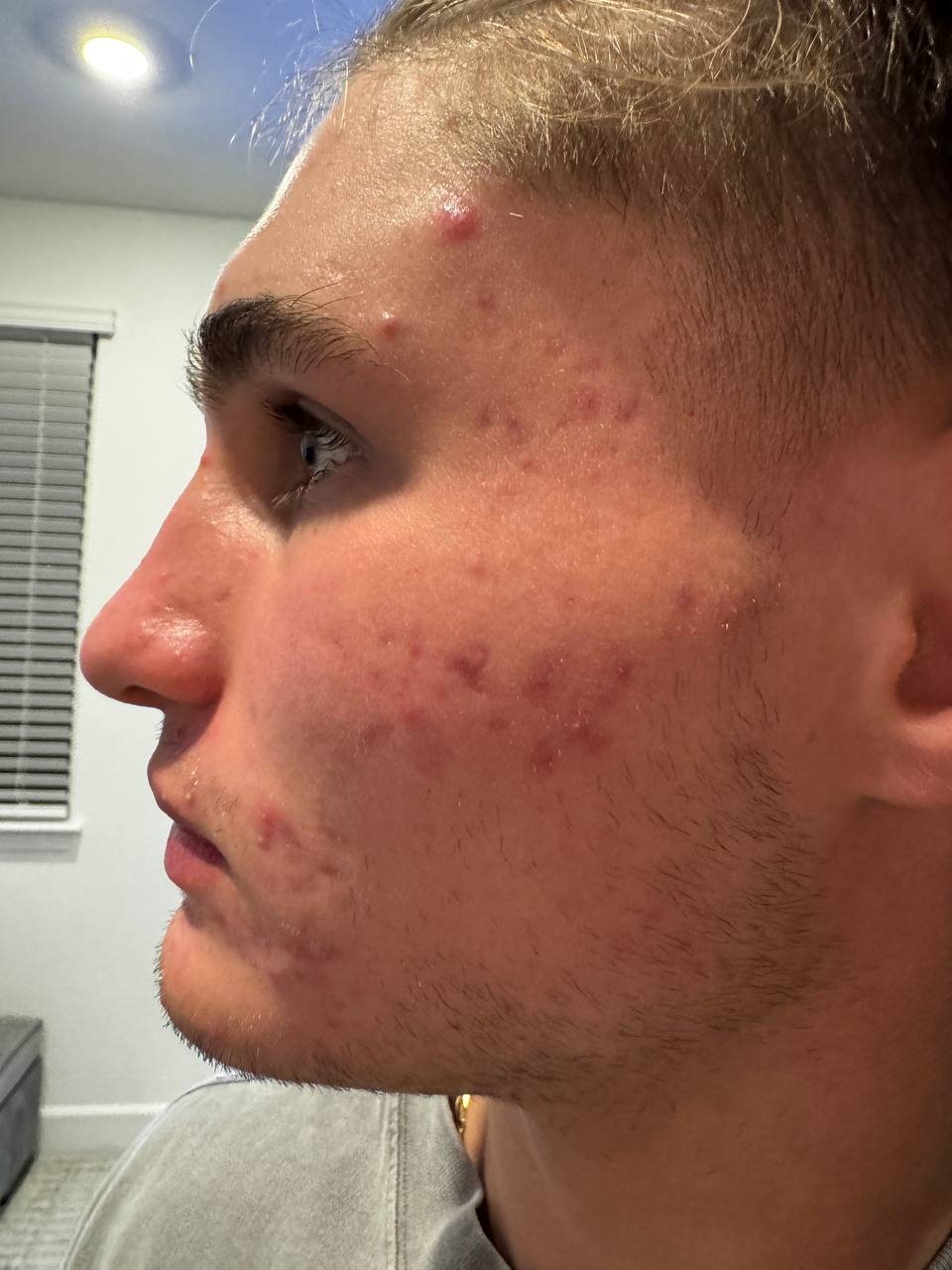 Skin at H.A. Skin Lab, treatment photo