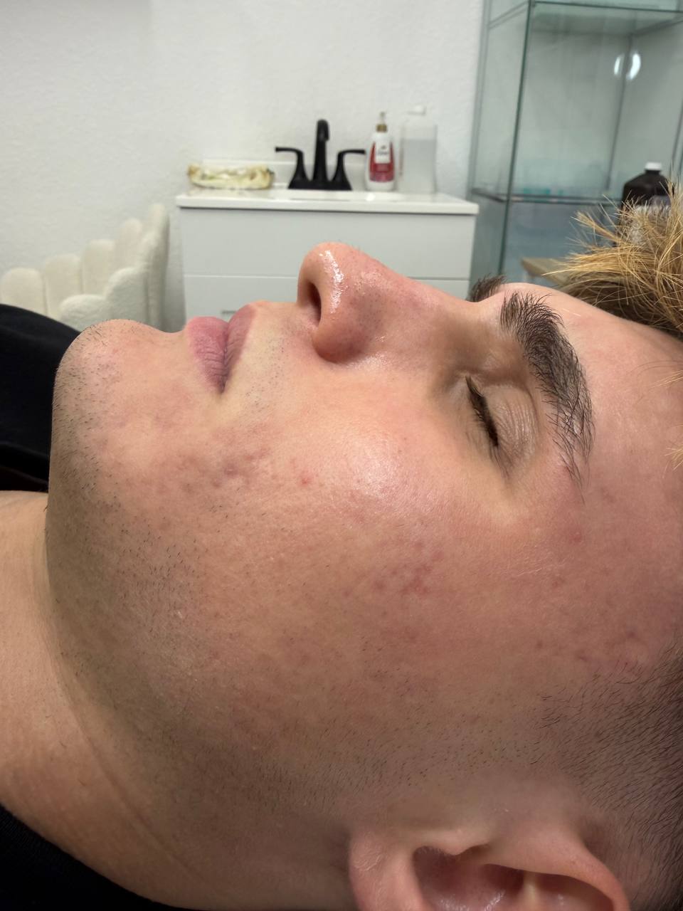Skin at H.A. Skin Lab, treatment photo